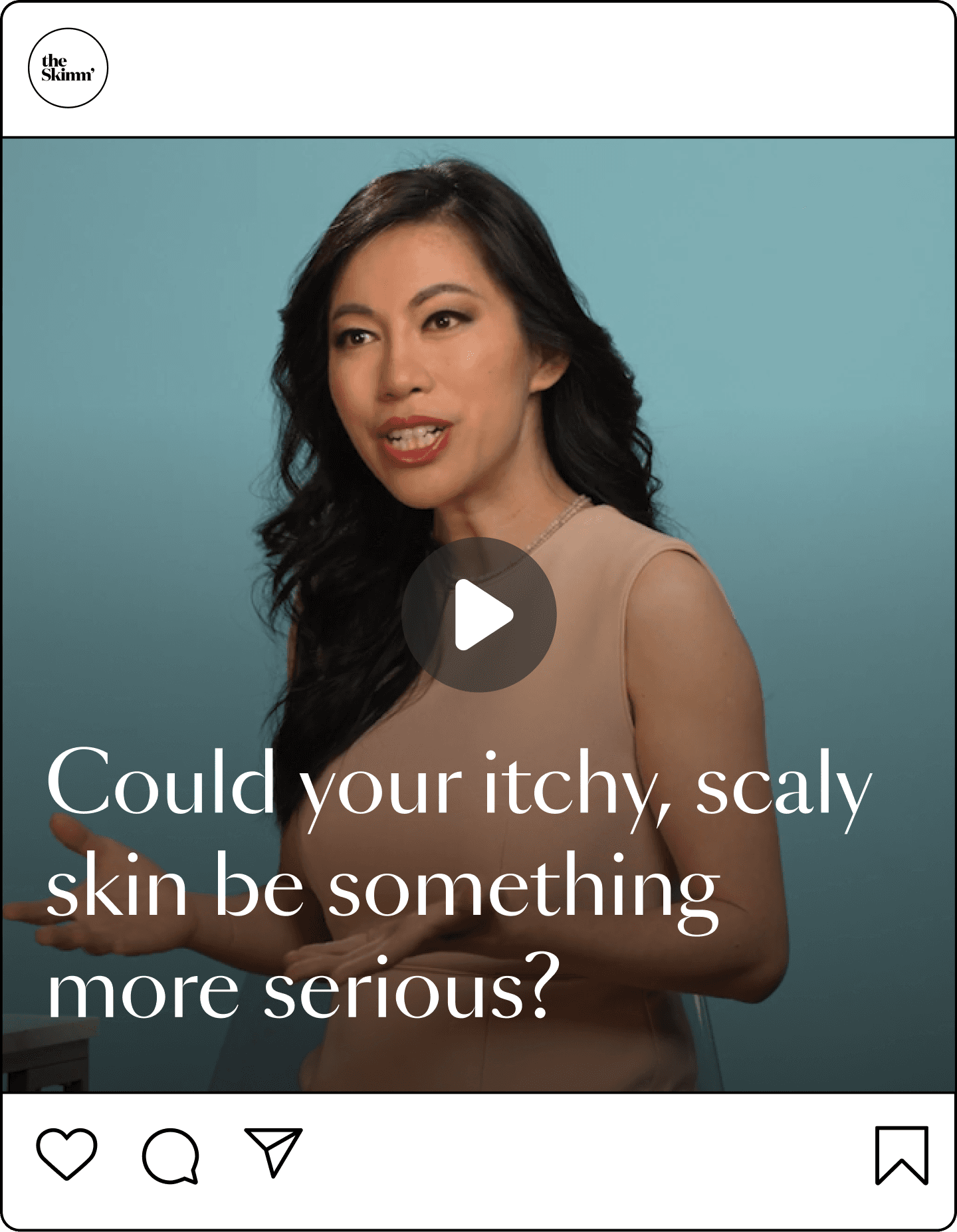 could your itchy skin be something more serious?